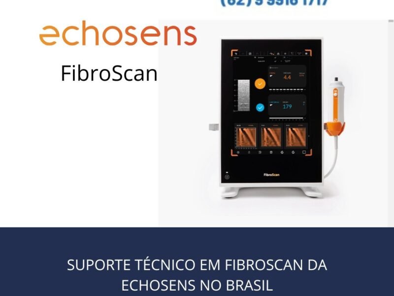 ASSISTÊNCIA-TÉCNICA-EM-FIBRO-SCAN-BRASIL